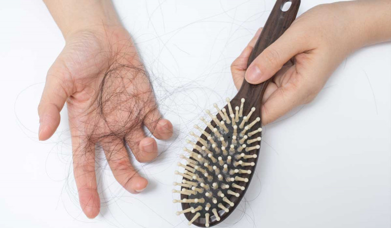 hair transplant for women hair loss